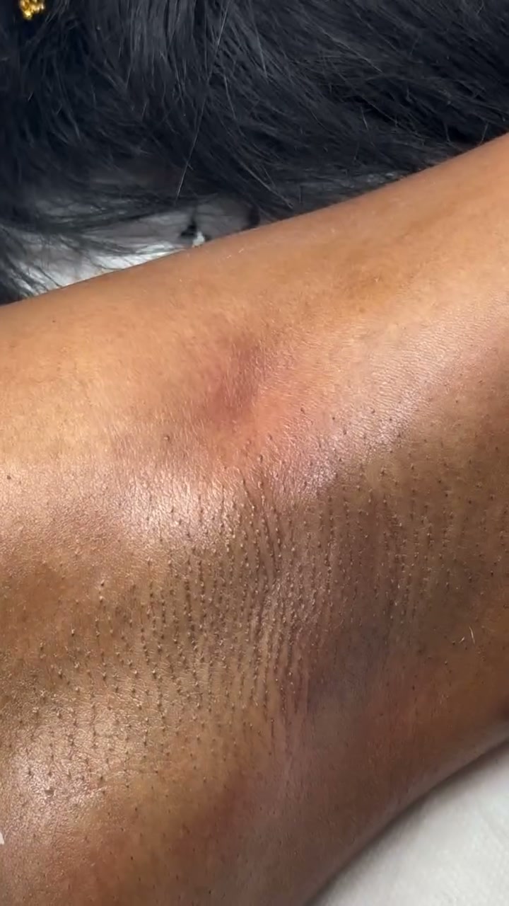 Vidéo Soin Purifiant Aisselles + Épilation chez Boole Paris