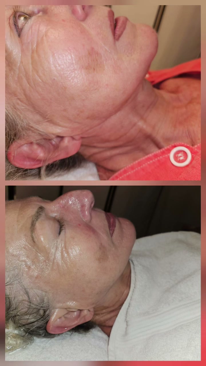 Vidéo Soin du visage peeling peau neuve chez Body Perfect by Marysa
